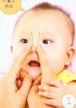 Akut adenoiditis