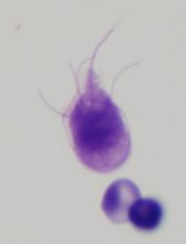 Ramsey Giardia