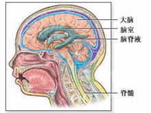 Cranial nervskada