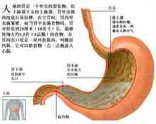 Gastric dilatation
